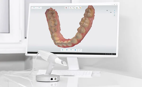 Dental 3d scanner and monitor in the dentist's office Dental 3d scanner and monitor in the dentist's office